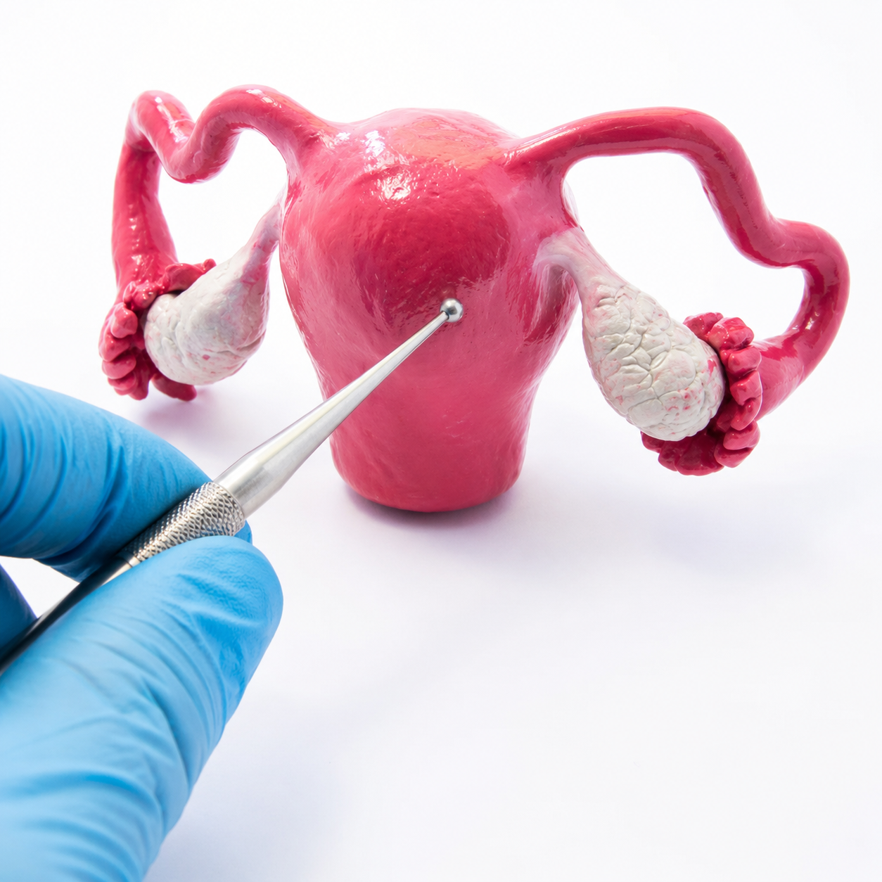 Hysteroscopy procedure for uterine evaluation at Blossom Hospital